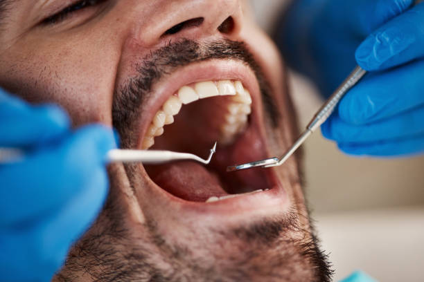 Best Pediatric Emergency Dentist in Watervliet, MI